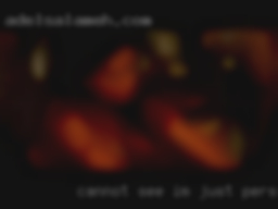 Cannot see IM, just personal message.